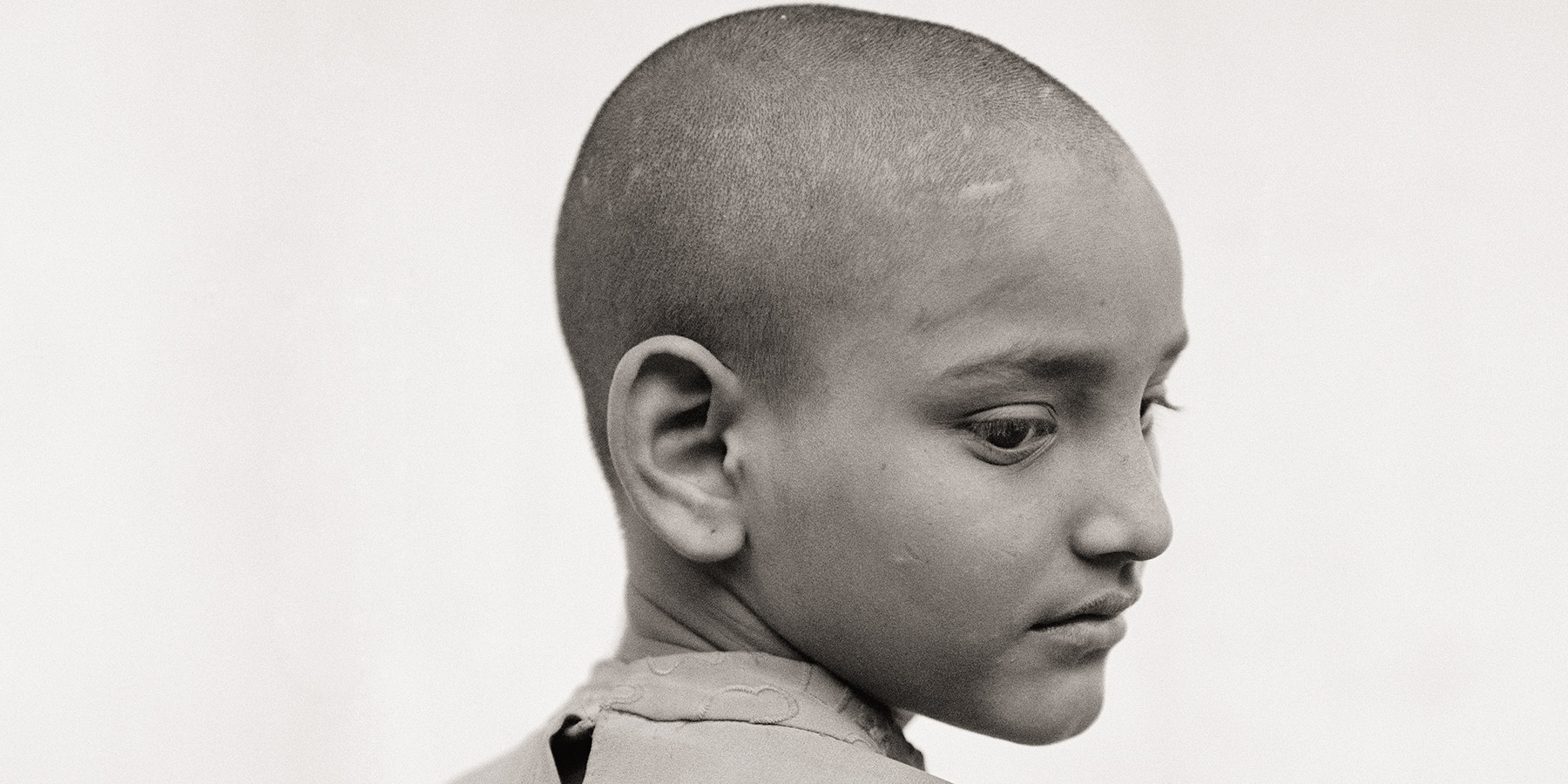 Black and white image of a young child with a shaved head, back to the viewer, and head turned around looking over her right shoulder and downward at the viewer