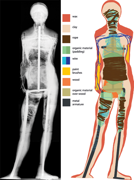 radiograph and diagram Little Dancer Aged Fourteen